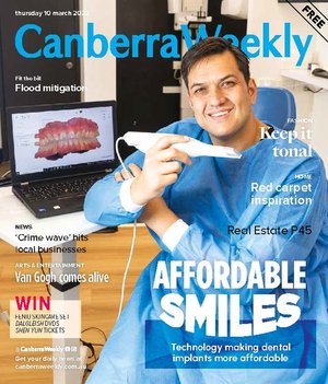 3d technology changing the face of leading local dental implant and denture clinic